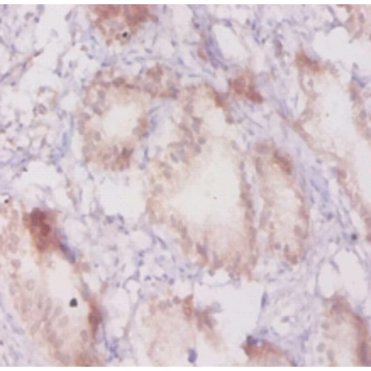 Immunohistochemistry - Beta-adrenergic receptor kinase 1 Polyclonal Antibody from Signalway Antibody (42189)