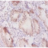 Immunohistochemistry - Beta-adrenergic receptor kinase 1 Polyclonal Antibody from Signalway Antibody (42189)