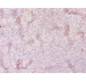 Immunohistochemistry - Solute carrier family 41 member 2 Polyclonal Antibody from Signalway Antibody (42324)