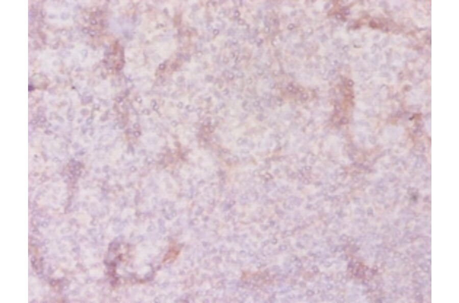 Immunohistochemistry - Solute carrier family 41 member 2 Polyclonal Antibody from Signalway Antibody (42324)