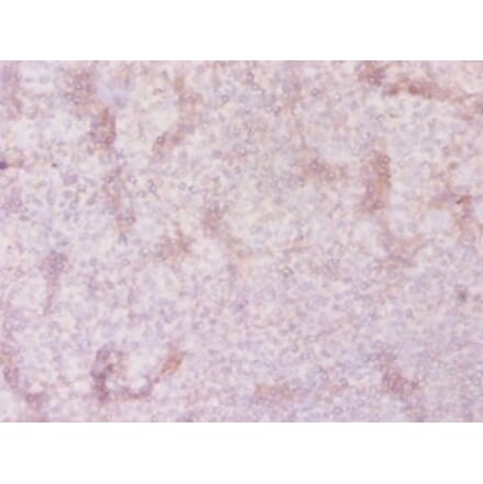Immunohistochemistry - Solute carrier family 41 member 2 Polyclonal Antibody from Signalway Antibody (42324)