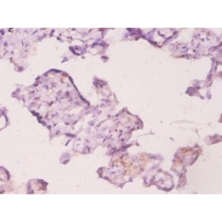 Immunohistochemistry - Ubiquitin-conjugating enzyme E2 K Polyclonal Antibody from Signalway Antibody (42507)