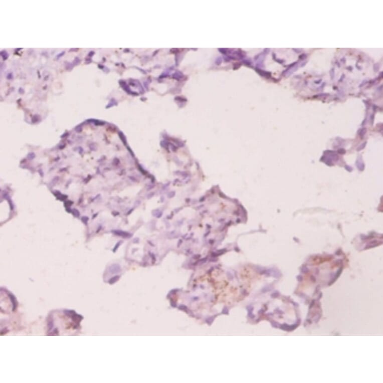 Immunohistochemistry - Ubiquitin-conjugating enzyme E2 K Polyclonal Antibody from Signalway Antibody (42507)