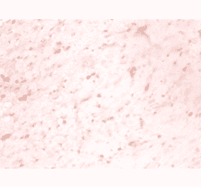 Immunohistochemistry - Microtubule-associated protein 1S Polyclonal Antibody from Signalway Antibody (42570)