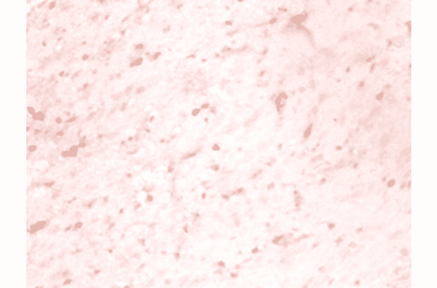 Immunohistochemistry - Microtubule-associated protein 1S Polyclonal Antibody from Signalway Antibody (42570)