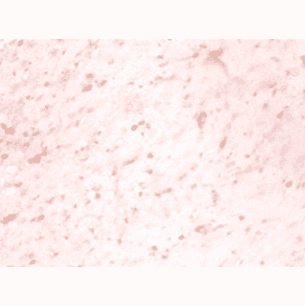 Immunohistochemistry - Microtubule-associated protein 1S Polyclonal Antibody from Signalway Antibody (42570)