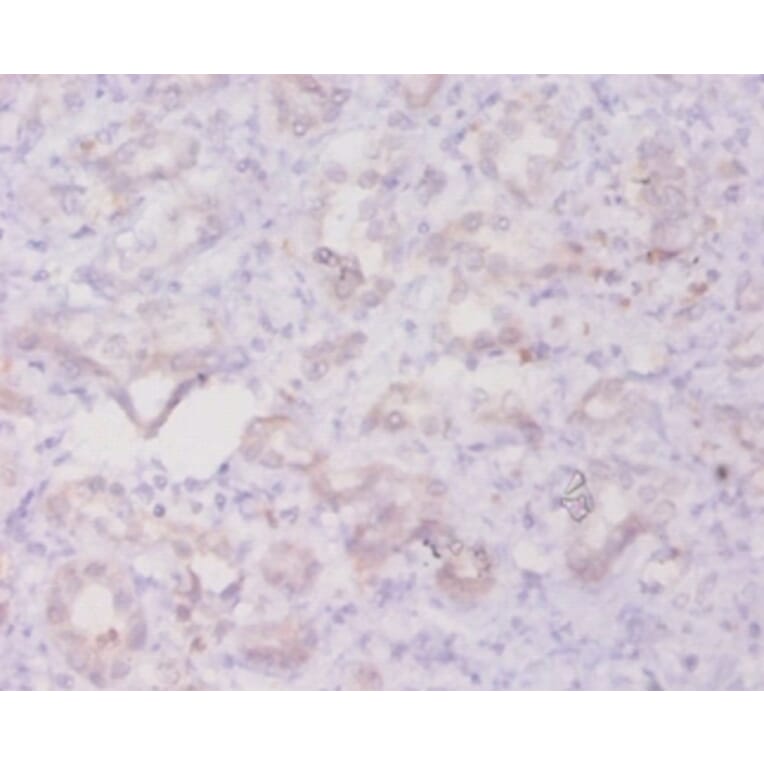 Immunohistochemistry - Transforming growth factor beta-3 Polyclonal Antibody from Signalway Antibody (42614)