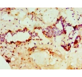 Immunohistochemistry - Protein-arginine deiminase type-2 Polyclonal Antibody from Signalway Antibody (42694)