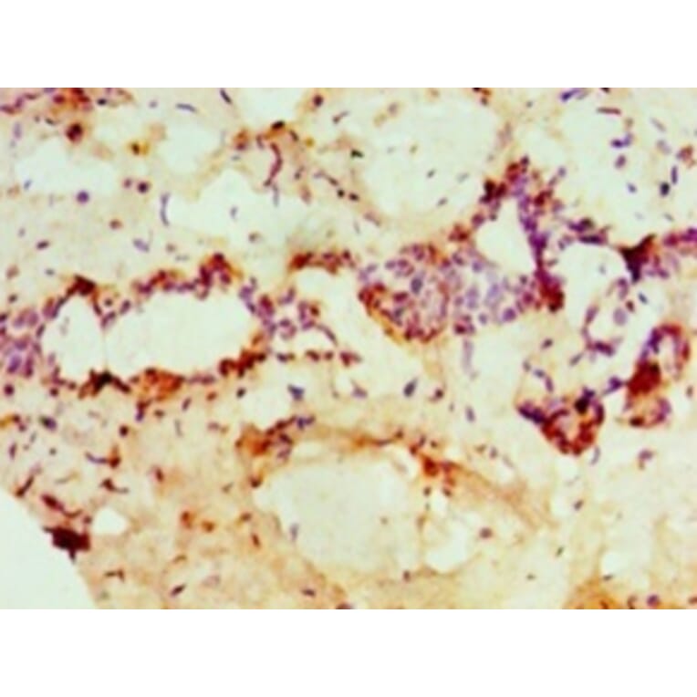 Immunohistochemistry - Protein-arginine deiminase type-2 Polyclonal Antibody from Signalway Antibody (42694)