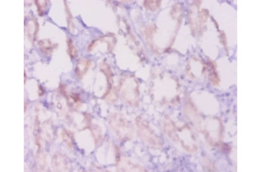 Immunohistochemistry - Apoptosis regulator Bcl-2 Polyclonal Antibody from Signalway Antibody - Antibodies.com
