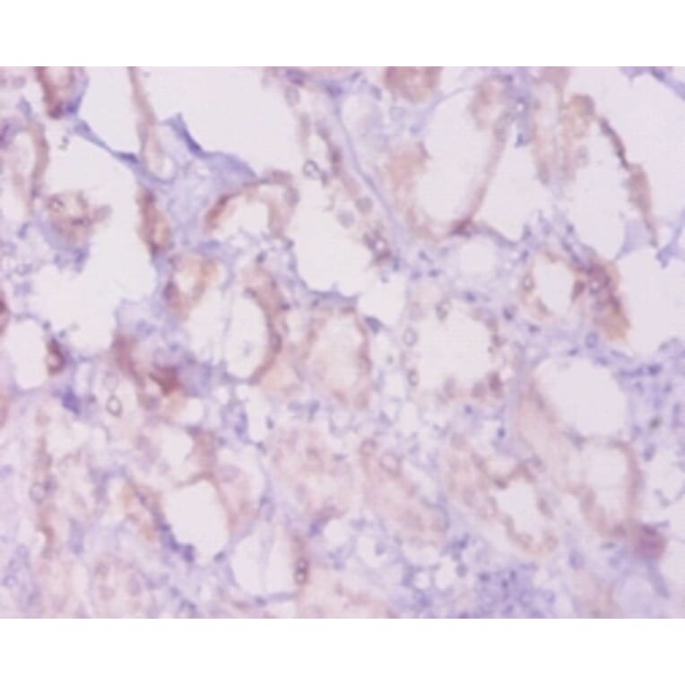 Immunohistochemistry - Apoptosis regulator Bcl-2 Polyclonal Antibody from Signalway Antibody - Antibodies.com