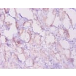Immunohistochemistry - Apoptosis regulator Bcl-2 Polyclonal Antibody from Signalway Antibody - Antibodies.com