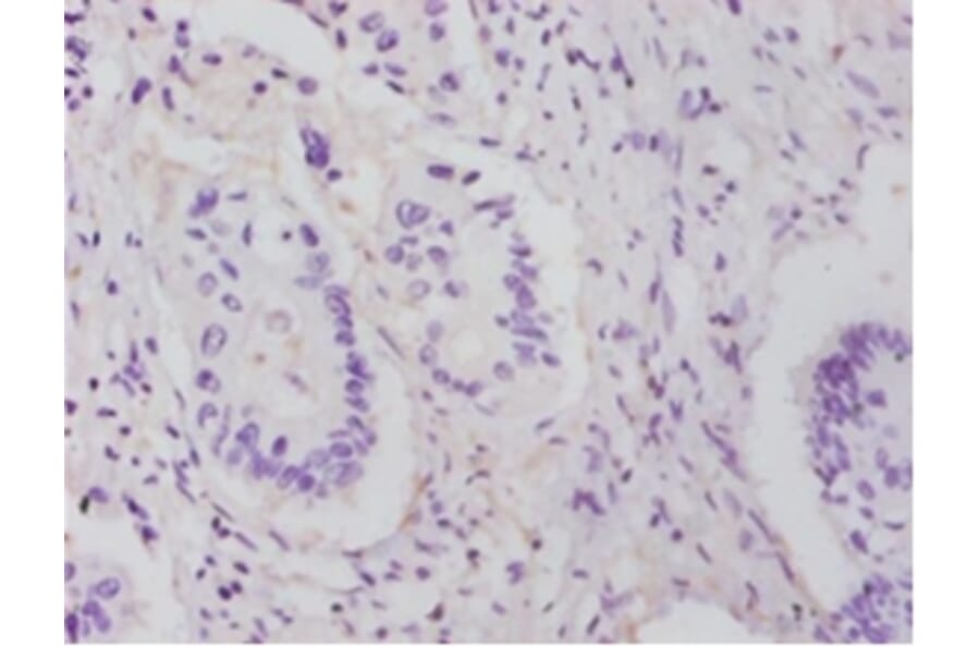 Immunohistochemistry - 60S ribosomal protein L14 Polyclonal Antibody from Signalway Antibody - Antibodies.com