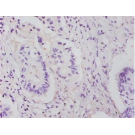 Immunohistochemistry - 60S ribosomal protein L14 Polyclonal Antibody from Signalway Antibody - Antibodies.com