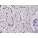 Immunohistochemistry - 60S ribosomal protein L14 Polyclonal Antibody from Signalway Antibody - Antibodies.com