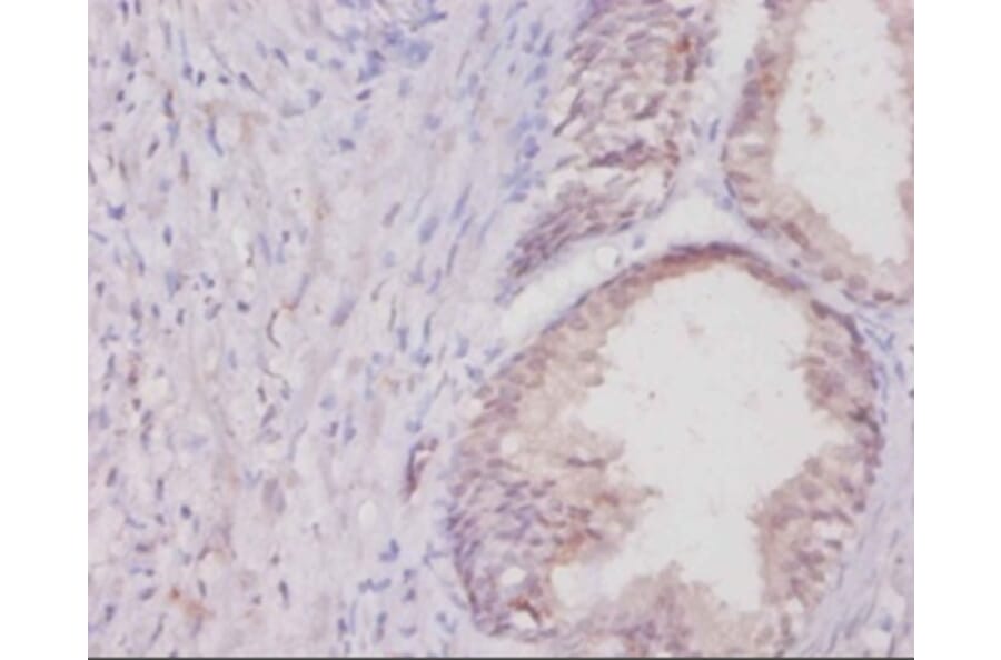 Immunohistochemistry - Collagen alpha-1 (I) chain Polyclonal Antibody from Signalway Antibody - Antibodies.com