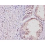 Immunohistochemistry - Collagen alpha-1 (I) chain Polyclonal Antibody from Signalway Antibody - Antibodies.com