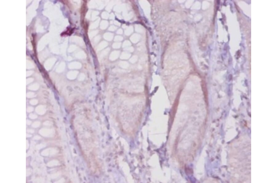 Immunohistochemistry - Collagen alpha-1 (I) chain Polyclonal Antibody from Signalway Antibody - Antibodies.com