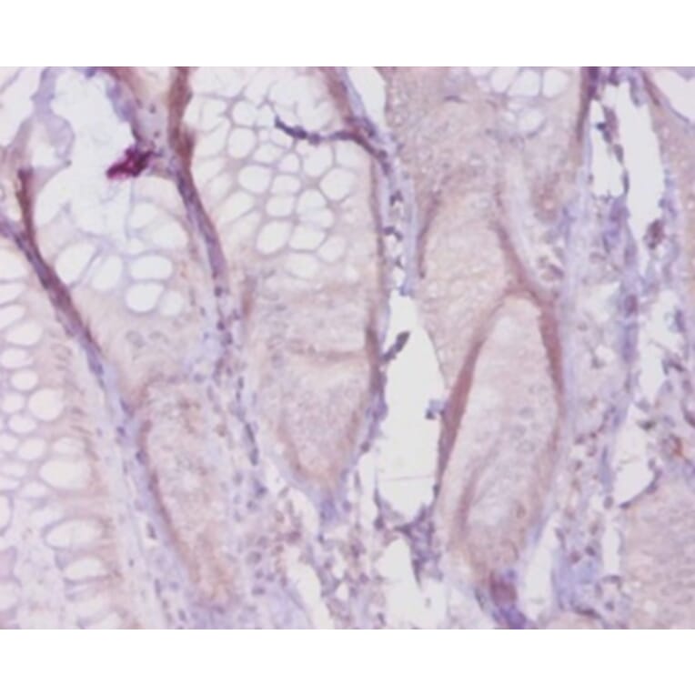 Immunohistochemistry - Collagen alpha-1 (I) chain Polyclonal Antibody from Signalway Antibody - Antibodies.com