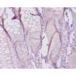 Immunohistochemistry - Collagen alpha-1 (I) chain Polyclonal Antibody from Signalway Antibody - Antibodies.com