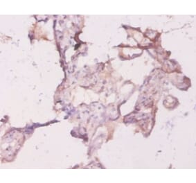 Immunohistochemistry - Transforming protein RhoA Polyclonal Antibody from Signalway Antibody - Antibodies.com