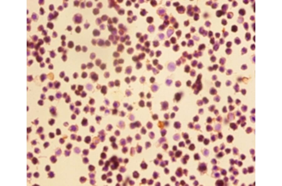 Immunohistochemistry - Cyclin-dependent kinase 4 Polyclonal Antibody from Signalway Antibody - Antibodies.com