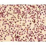 Immunohistochemistry - Cyclin-dependent kinase 4 Polyclonal Antibody from Signalway Antibody - Antibodies.com