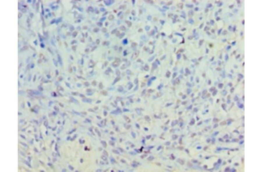 Immunohistochemistry - Inactive phospholipase D5 Polyclonal Antibody from Signalway Antibody - Antibodies.com