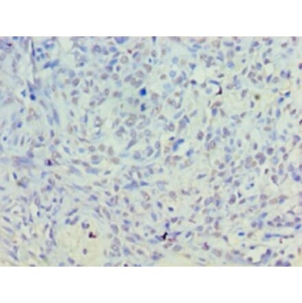 Immunohistochemistry - Inactive phospholipase D5 Polyclonal Antibody from Signalway Antibody - Antibodies.com