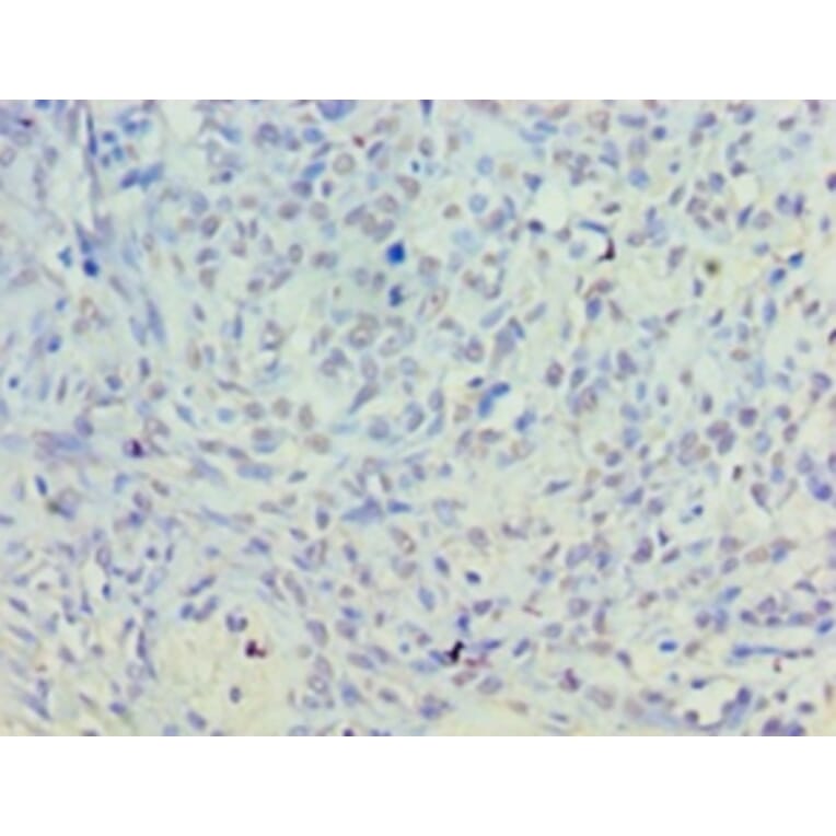 Immunohistochemistry - Inactive phospholipase D5 Polyclonal Antibody from Signalway Antibody - Antibodies.com