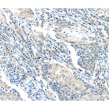 Immunohistochemistry - BOK (BH3 domain) Antibody from Signalway Antibody (40191) - Antibodies.com