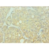 Immunohistochemistry - AHSG Monoclonal Antibody from Signalway Antibody (42014) - Antibodies.com