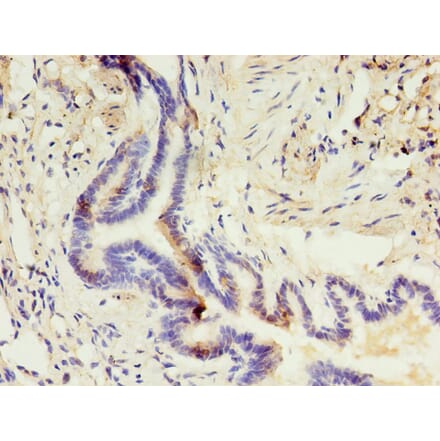 Immunohistochemistry - CD14 Monoclonal Antibody from Signalway Antibody (42017) - Antibodies.com