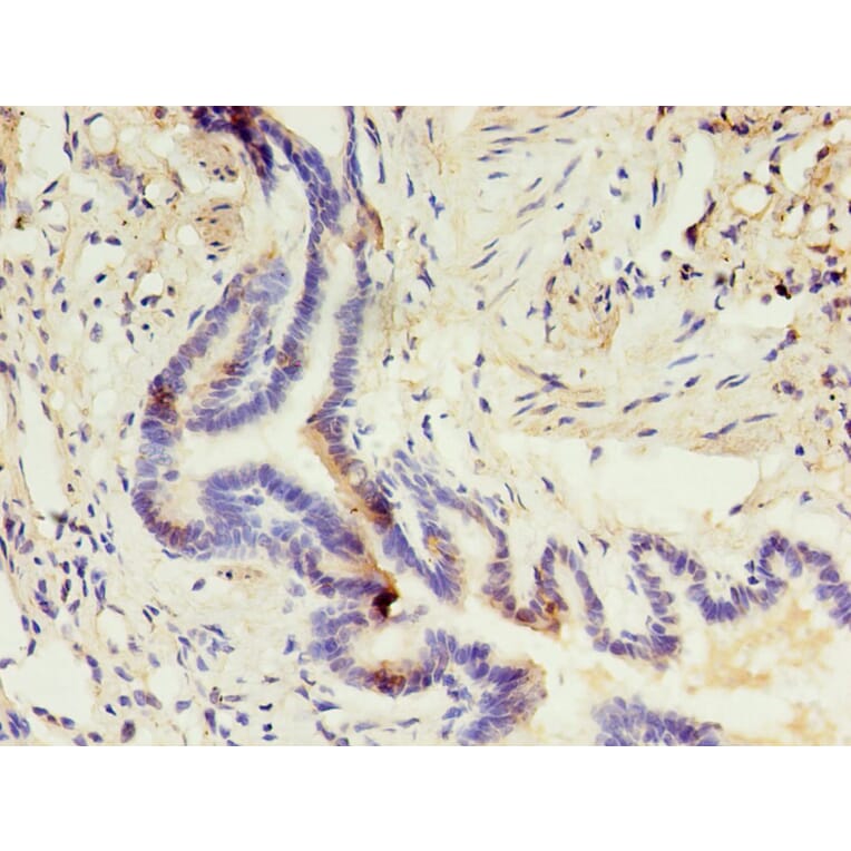 Immunohistochemistry - CD14 Monoclonal Antibody from Signalway Antibody (42017) - Antibodies.com