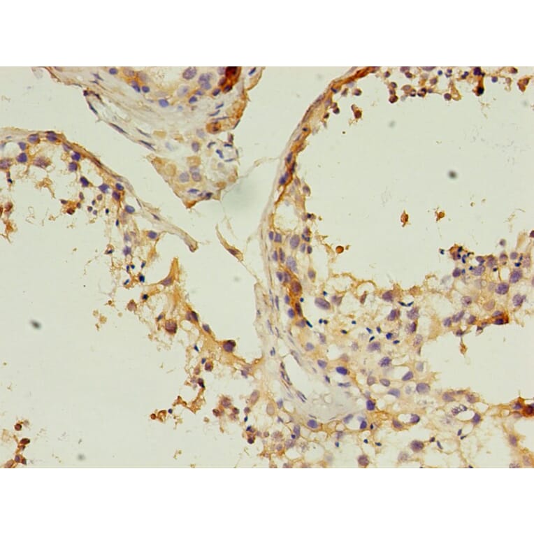 Immunohistochemistry - CD14 Monoclonal Antibody from Signalway Antibody (42017) - Antibodies.com