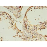 Immunohistochemistry - CD14 Monoclonal Antibody from Signalway Antibody (42017) - Antibodies.com