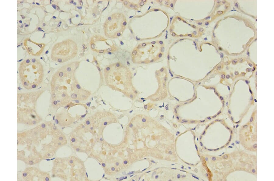 Immunohistochemistry - CD14 Monoclonal Antibody from Signalway Antibody (42017) - Antibodies.com