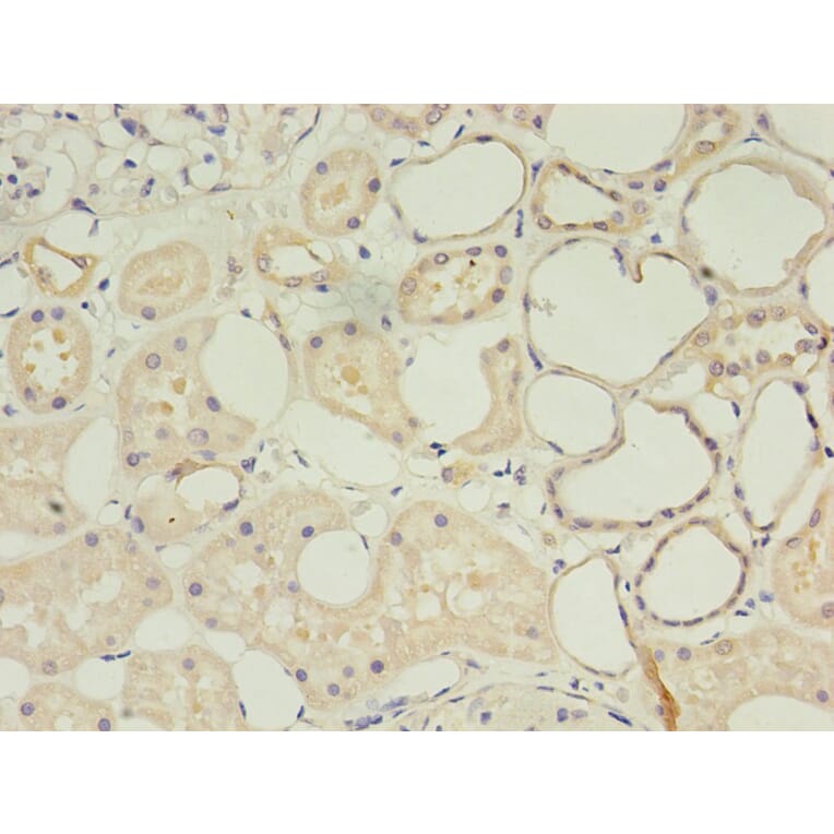 Immunohistochemistry - CD14 Monoclonal Antibody from Signalway Antibody (42017) - Antibodies.com