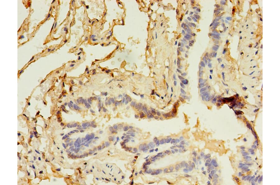 Immunohistochemistry - CD14 Monoclonal Antibody from Signalway Antibody (42017) - Antibodies.com
