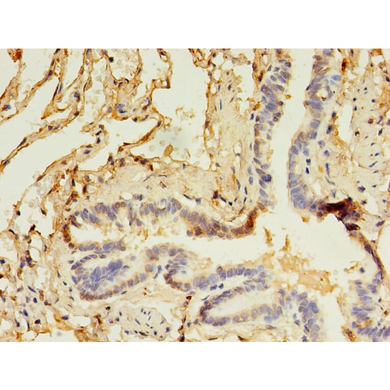 Immunohistochemistry - CD14 Monoclonal Antibody from Signalway Antibody (42017) - Antibodies.com