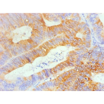 Immunohistochemistry - TFF3 Monoclonal Antibody from Signalway Antibody (42028) - Antibodies.com