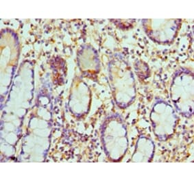 Immunohistochemistry - CCL8 Polyclonal Antibody from Signalway Antibody (42106) - Antibodies.com
