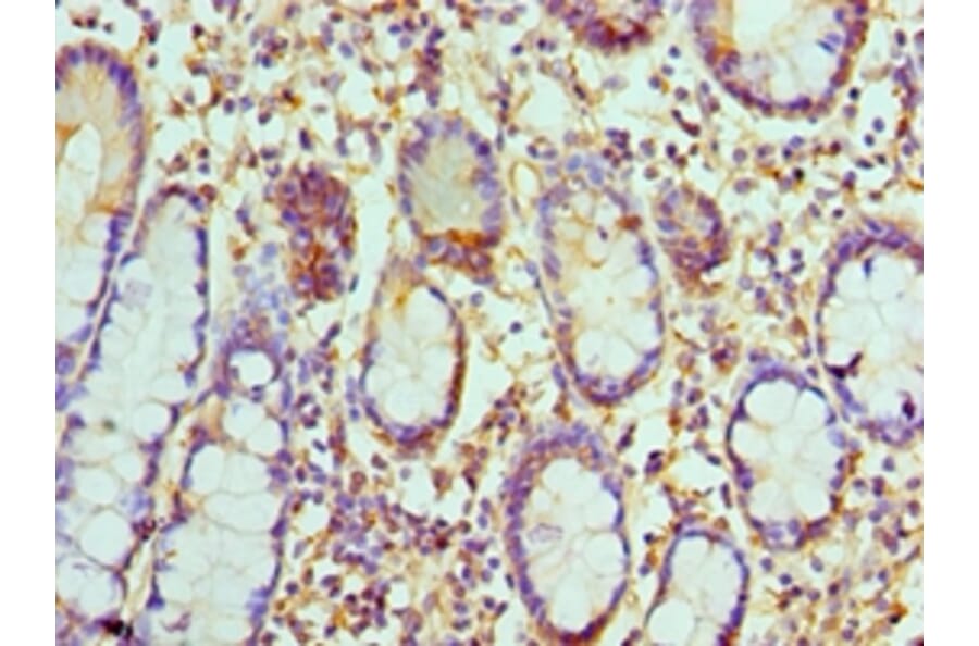 Immunohistochemistry - CCL8 Polyclonal Antibody from Signalway Antibody (42106) - Antibodies.com