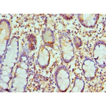 Immunohistochemistry - CCL8 Polyclonal Antibody from Signalway Antibody (42106) - Antibodies.com