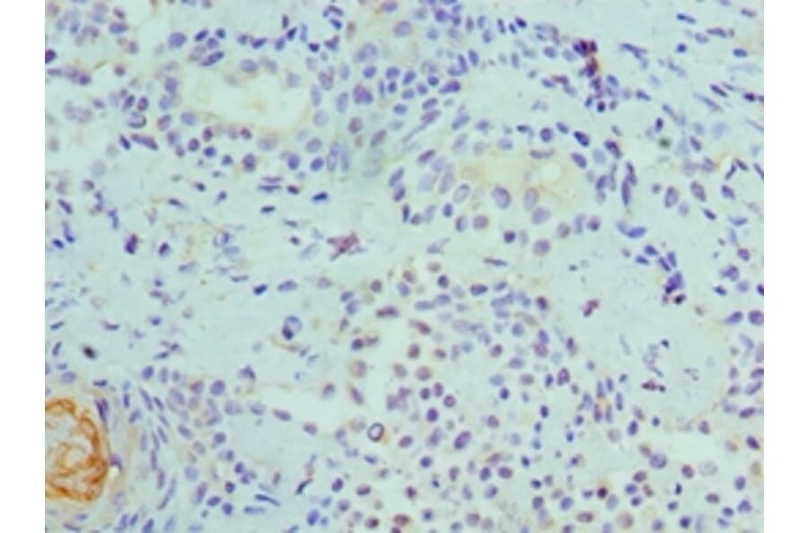 Immunohistochemistry - CDK8 Polyclonal Antibody from Signalway Antibody (42114) - Antibodies.com