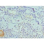 Immunohistochemistry - CDK8 Polyclonal Antibody from Signalway Antibody (42114) - Antibodies.com