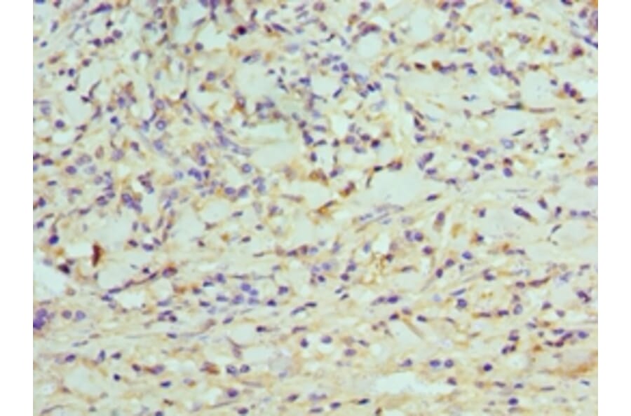 Immunohistochemistry - CDK8 Polyclonal Antibody from Signalway Antibody (42114) - Antibodies.com