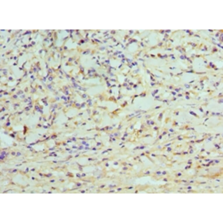 Immunohistochemistry - CDK8 Polyclonal Antibody from Signalway Antibody (42114) - Antibodies.com