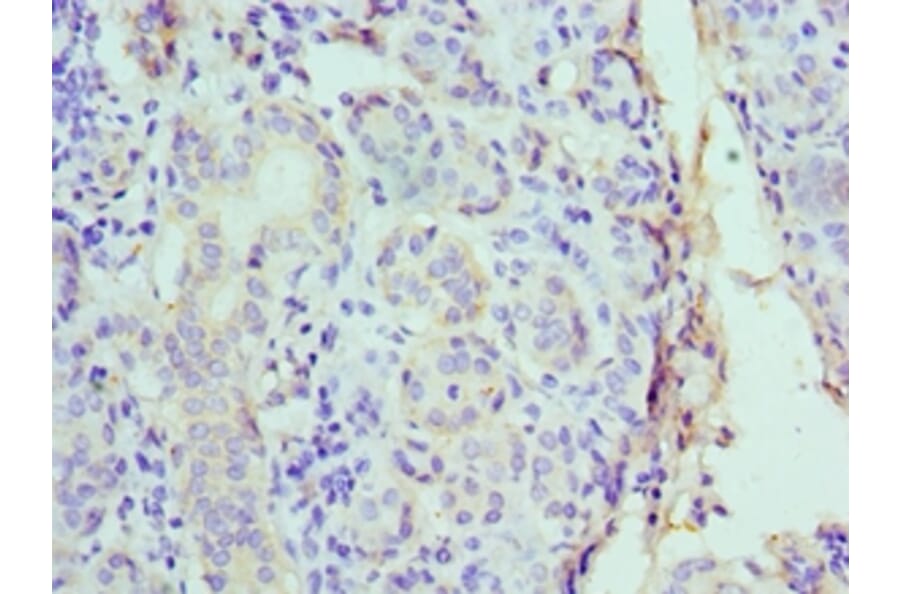 Immunohistochemistry - CST1 Polyclonal Antibody from Signalway Antibody (42138) - Antibodies.com