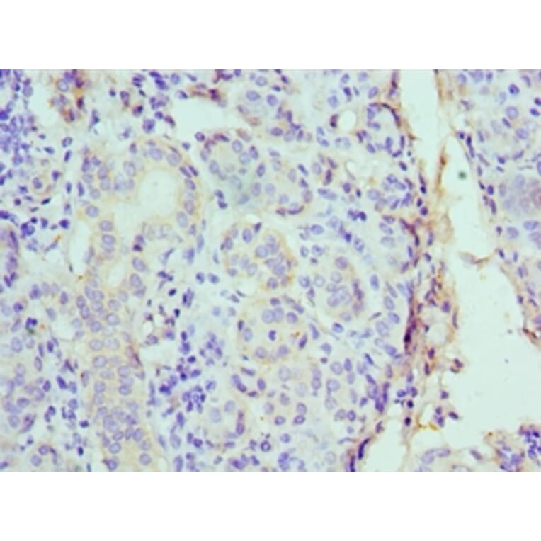 Immunohistochemistry - CST1 Polyclonal Antibody from Signalway Antibody (42138) - Antibodies.com